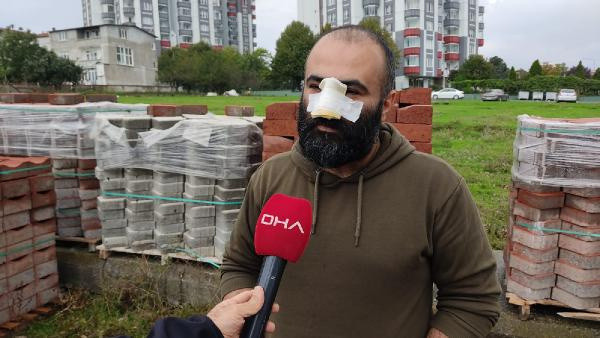 Samsun'da iş insanı aynaya bakamaz hale geldi! Yüzüne atlayıp burnunu kopardı - Resim: 1