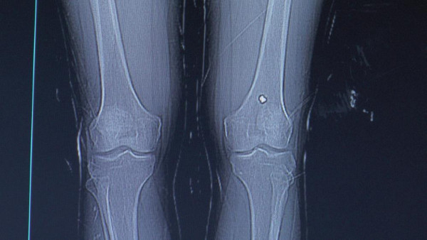 Nevşehir'de dizi ağrıyınca doktora gitti! Gerçeği öğrenince inanamadı - Resim: 0