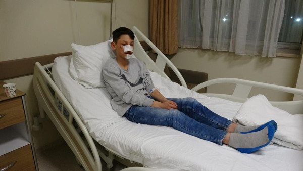 Tokat'ta ekmek almaya giderken dehşeti yaşadı! Kanlar içinde kaldı: Bacağım koparabilirdi - Resim: 0