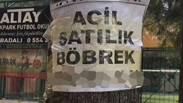 'Böbreğimi satmak istiyorum’ diyenlerin sayısı yüzde 400 arttı! En çok bu 3 il satmak istiyor - Resim: 2