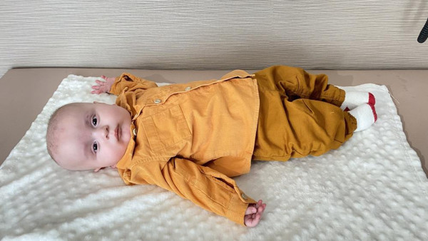 Anne sütü dahil türlü protein yasak! 200 binde bir görülüyor: 10 aylık Mehmet hayata tutundu - Resim: 0