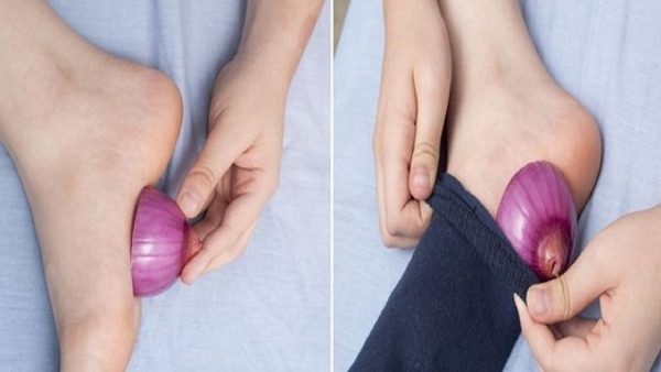 Ayaklarınıza soğanı kesip bir gece bekletin ve etkisini hissedin - Resim: 0