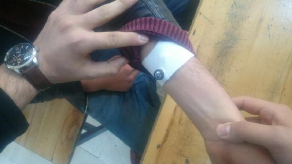 İnanılmaz olay! Öğretmenler kolunu açınca şoke oldu - Resim: 4