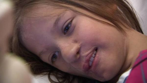 3 aylıkken yüzünü rakun parçaladı 11 yıl sonra ise... - Resim: 4