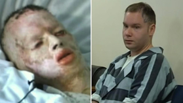 Bu hale getirdi 8 yaşındaki çocuğu ağaca bağlayıp önce diri diri yaktı sonra... - Resim: 4