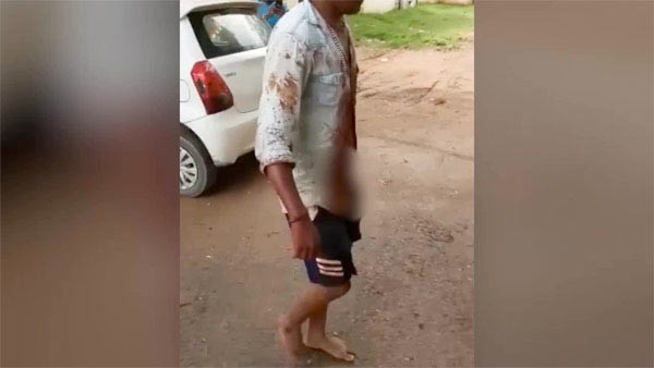 Yasak aşk dehşeti! Kesik başla 20 kilometre - Resim: 1