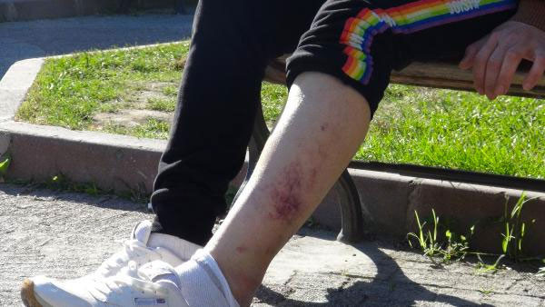 Bir kadın feryat ediyor! Boynumu kırdı dişlerimi döktü kurtarın beni... - Resim: 3