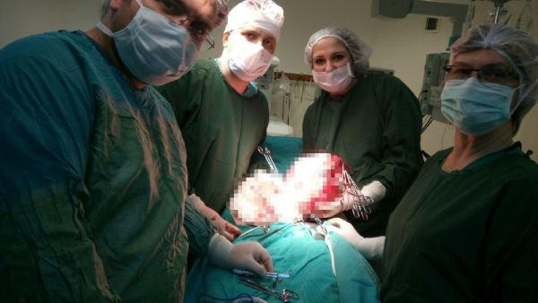 Sürekli kilo alan kadının karnından çıkan şeye bakın! - Resim: 2