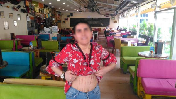 Dövülmedi! Yaptırdığı lazer epilasyon bu hale getirdi - Resim: 3