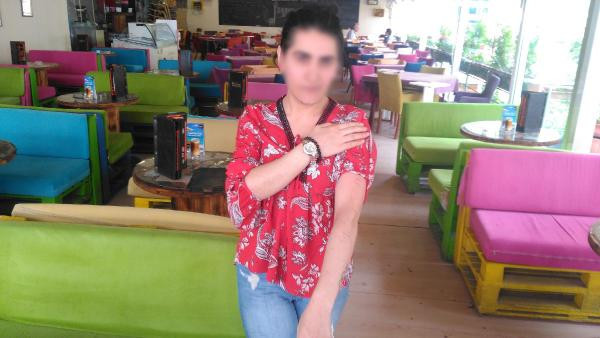 Dövülmedi! Yaptırdığı lazer epilasyon bu hale getirdi - Resim: 4