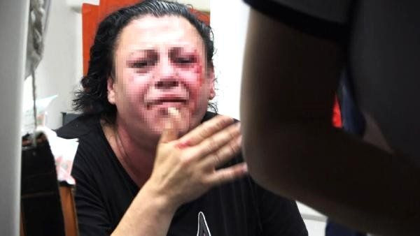 Escort sitesinde tanıştı! Gerçeği öğrenince parke taşıyla dövdü - Resim: 3