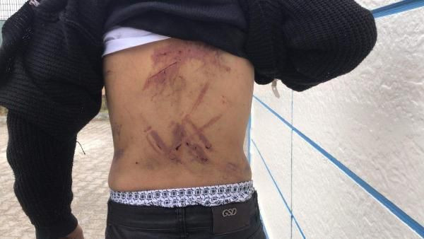 Mültecilere Yunan işkencesi askerler demir çubuklarla dövdü - Resim: 2