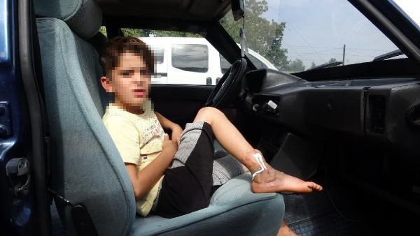 Bursa'da zincire vuralan çocuk yanmaktan son anda kurtuldu ailenin savunması inanılmaz - Resim: 1