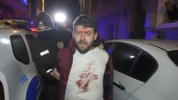 Bursa'da aile içi şiddetin fotoğrafı! 'Ben yaparım, beni tanıyan tanır' - Resim: 1