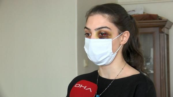 Telefonda video izlediği için kocasından dayak yedi: Ölmeyi mi bekleyeyim? - Resim: 1