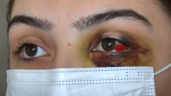 Telefonda video izlediği için kocasından dayak yedi: Ölmeyi mi bekleyeyim? - Resim: 2