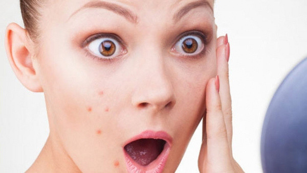 Bu yöntemler ile yüzünüzdeki sivilcelerden aynında kurtulabilirsiniz! - Resim: 0