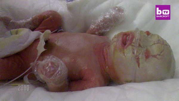 Dünya bu bebeği konuşuyor gelmiş geçmiş en garip hastalık! - Resim: 1