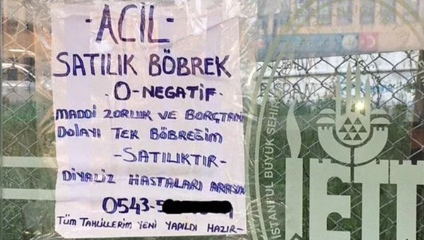 'Böbreğimi satmak istiyorum’ diyenlerin sayısı yüzde 400 arttı! En çok bu 3 il satmak istiyor - Resim: 1
