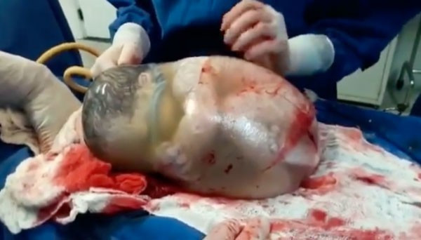 Bebek bu halde dünyaya geldi doktorlar şoke oldu - Resim: 2