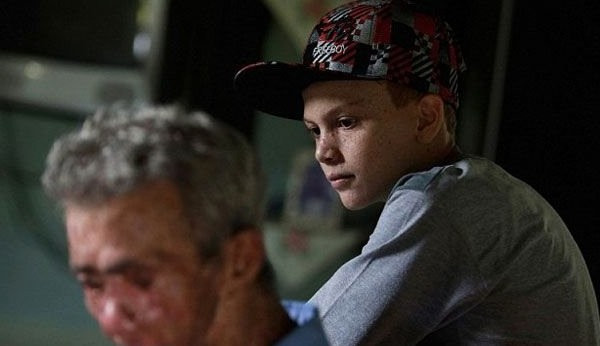 Bu köydeki herkes güneş görünce eriyor! - Resim: 2