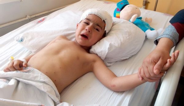 Van'da dehşet 8 köpek 5 yaşındaki çocuğa saldırdı - Resim: 3