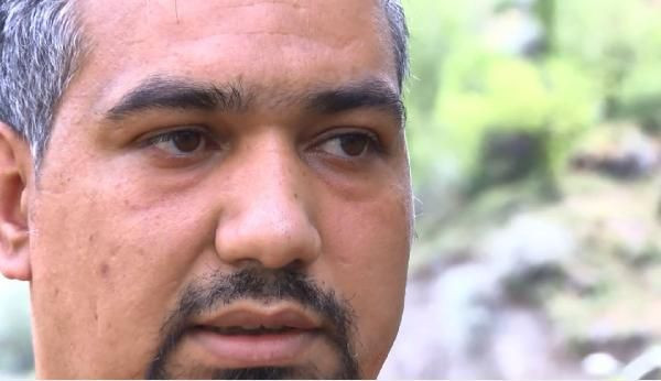 Ankara'da sivilce sandı mıknatıs tutunca şok oldu! Gerçek bakın ne çıktı - Resim: 1