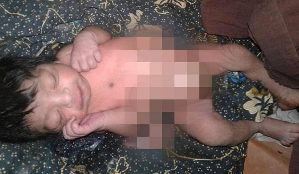 Dört ayak ve iki cinsel organla doğdu inanılmaz! - Resim: 3