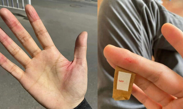 iPhone için ilginç şikayet! Yara yapmaya başladı - Resim: 0