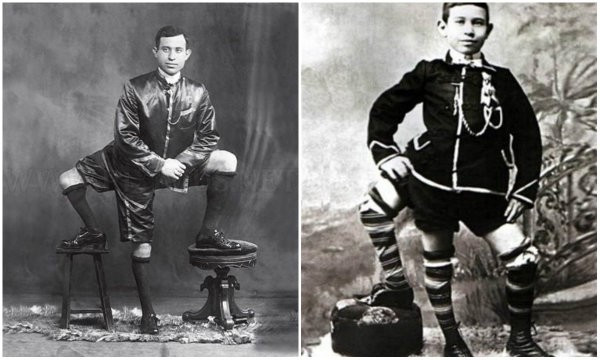 Onlar 4 bacakla dünyaya geldi görünce şoke olacaksınız - Resim: 3