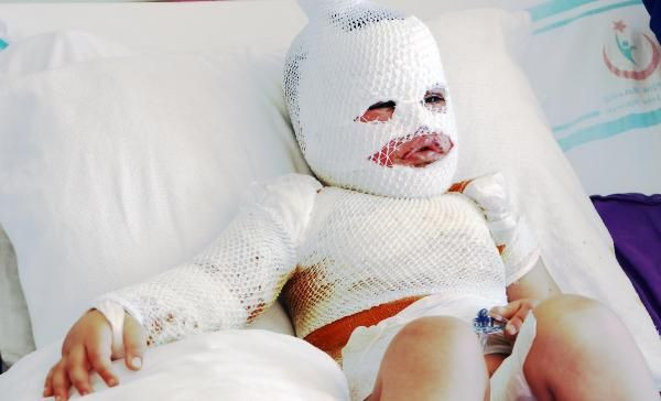 Konuşamıyor sadece ağlıyor! Kars'ta feci olay sonrası mumyaya döndü - Resim: 4