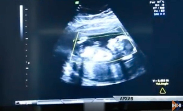 41 Haftalık hamileydi doktora gitmedi ama muayene edilince... - Resim: 3