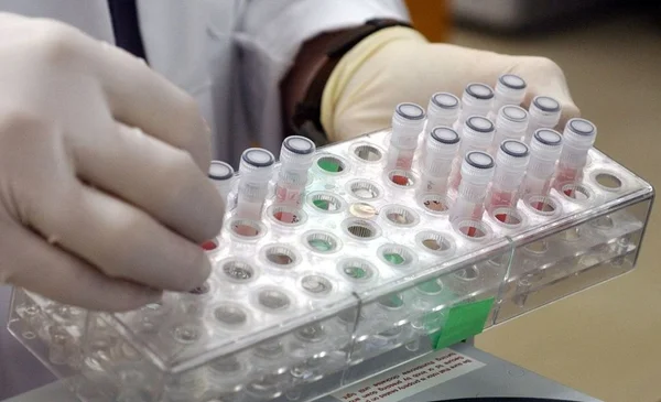 Maymun çiçeği virüsü sadece cinsel yolla mı bulaşıyor? Uzmanlar detaylarıyla açıkladı - Resim: 1