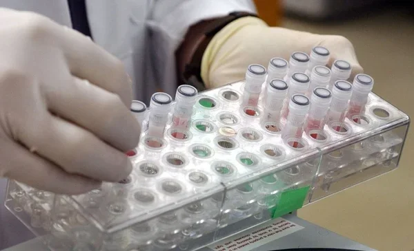 Maymun Çiçeği virüsünün yeni belirtileri ortaya çıktı! Özel bölgenizde bu değişiklikler varsa dikkat! - Resim: 3