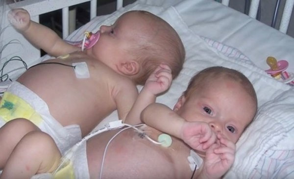 Doktor bebeğin karnındaki şişliği fark etti ve şoke oldu - Resim: 4