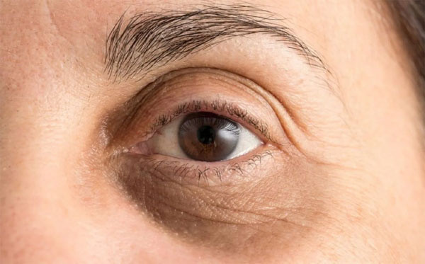 Göz Altı Morlukları bu yöntemler sayesinde yok oluyor! Morluklardan eser kalmıyor - Resim: 1