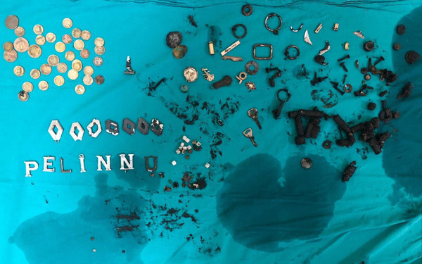 Midesinden çıkanlar doktorları bile hayrete düşürdü - Resim: 0