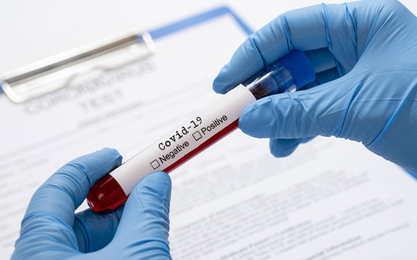 İngiliz devi AstraZeneca aşıyla ilgili güzel haberi duyurdu - Resim: 1