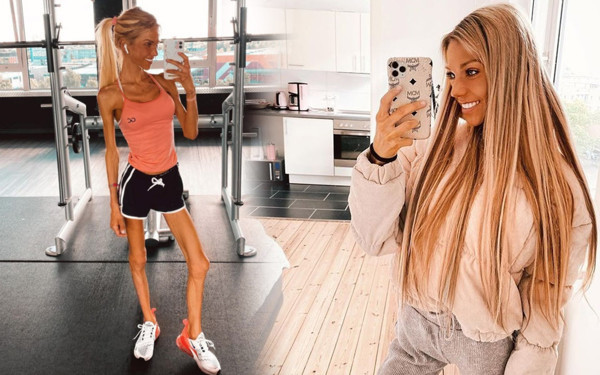 Ünlü sosyal medya fenomeni hayatını kaybetti! 2 gündür hiçbir şey yemedi - Resim: 0