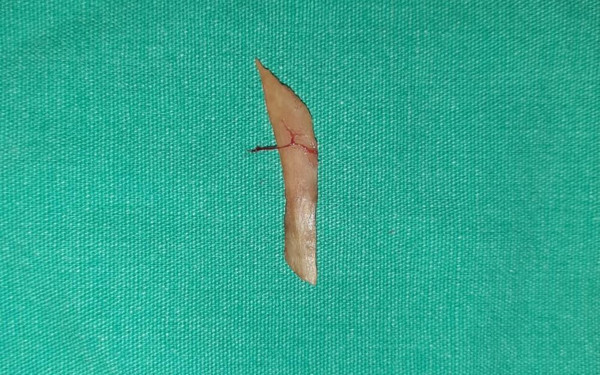 Mardin'de göğsünde yanma oluyordu! Gerçek doktora gidince ortaya çıktı: Birden bire böyle oldu - Resim: 1