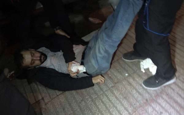 Çirkin saldırı! Kısıtlamayı ihlal eden boksör gazetecinin burnunu kırdı - Resim: 4