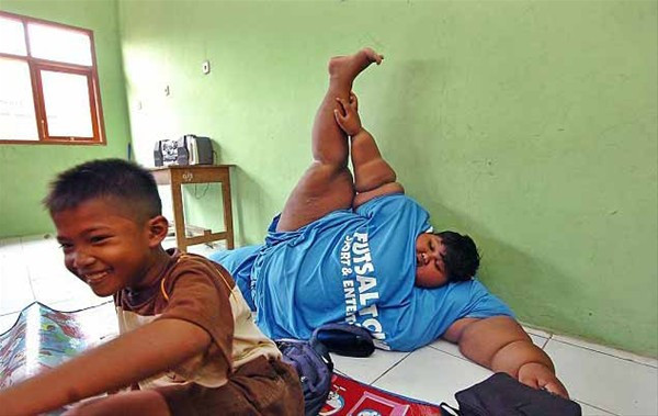 Dünyanın en kilolu çocuğuydu son haline bakın - Resim: 1