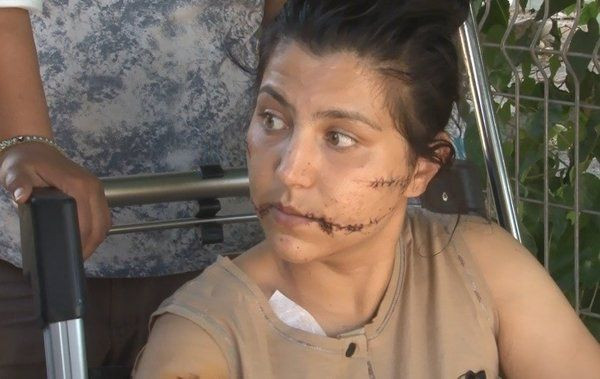 İzmir'de vahşet! Dini nikahlı eşini 104 yerinden bıçaklayıp ölmesini beklemiş! - Resim: 1