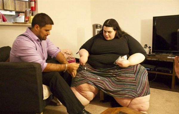 Kiloları başına dert olmuştu bu değişim inanılmaz - Resim: 2