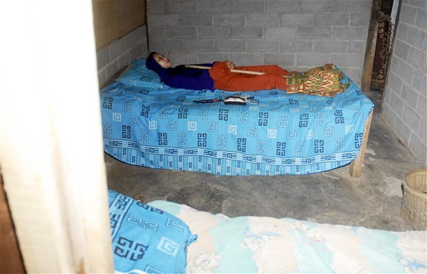 Doktorlar anlam veremedi bir anda alnında çıkana bakın - Resim: 3