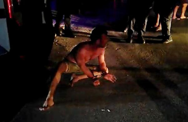 Eşini öldüresiye dövüp polise direnen koca tutuklandı - Resim: 0