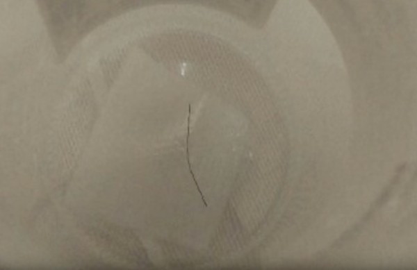 Küçük çocuk bir anda yer yığıldı içinden çıkan şey ise inanılmaz - Resim: 3