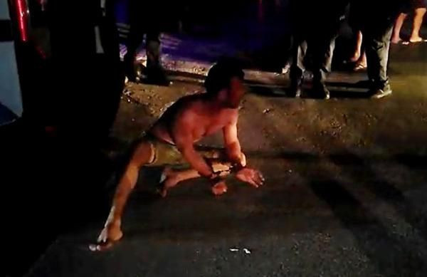 Alanya'da kocası tarafından öldüresiye dövülen kadını görenler dehşete kapıldı - Resim: 2