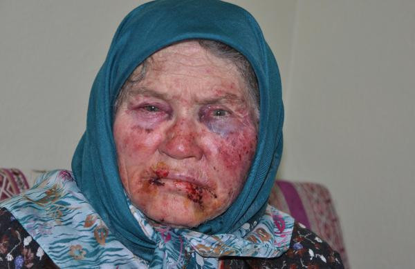 Bir bardak su istedi dehşeti yaşattı! Böyle canilik olmaz - Resim: 2