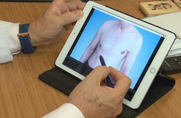 Röntgende tesadüfen çıkıyor: Erkekler bu hastalığı kendilerine konduramıyor - Resim: 2